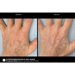 Load image into Gallery viewer, Marini ReNu Corrective Hand Complex
