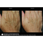 Load image into Gallery viewer, Marini ReNu Corrective Hand Complex
