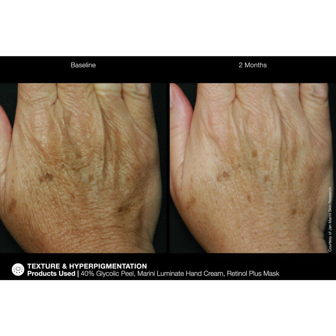 Marini ReNu Corrective Hand Complex