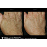 Load image into Gallery viewer, Marini ReNu Corrective Hand Complex
