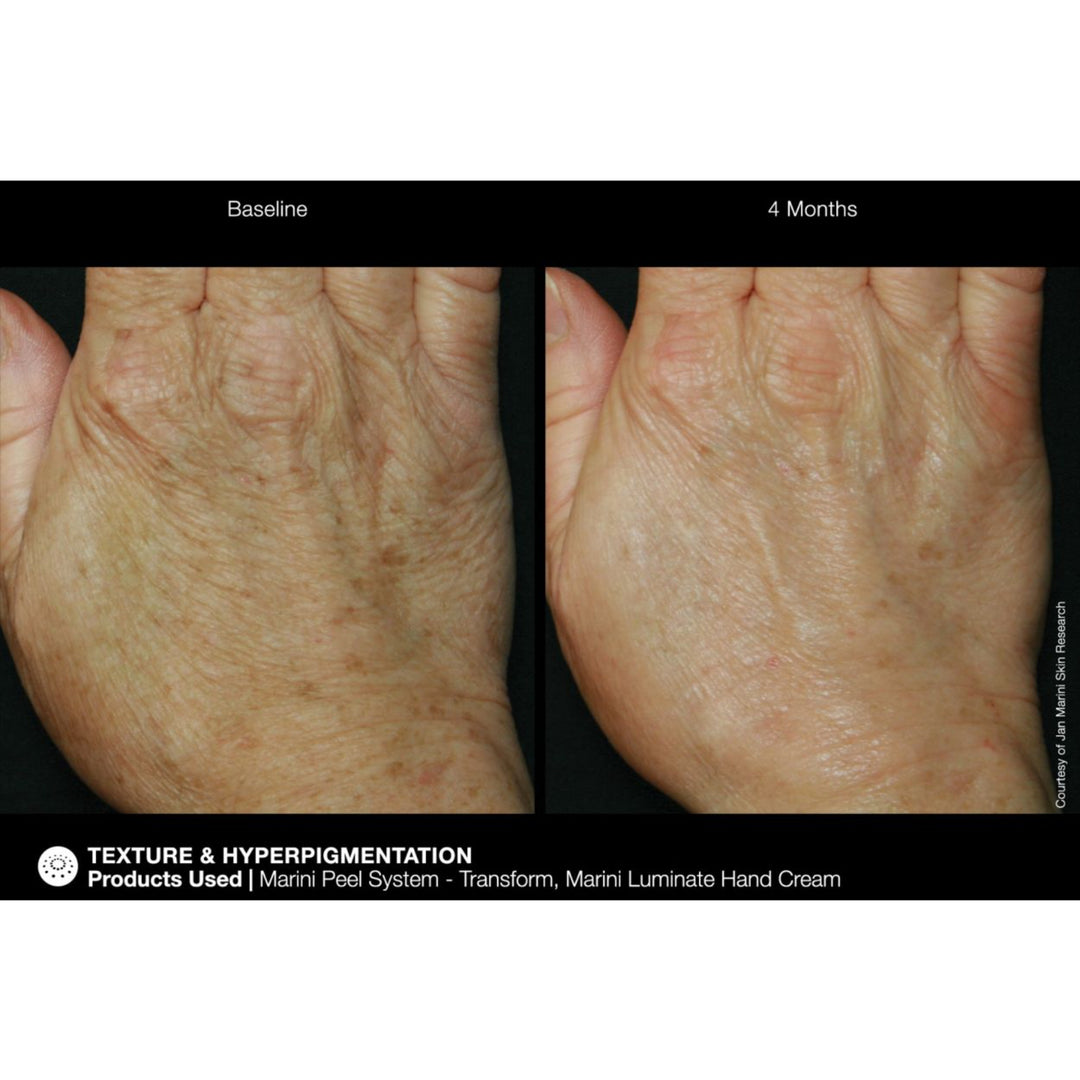 Marini ReNu Corrective Hand Complex